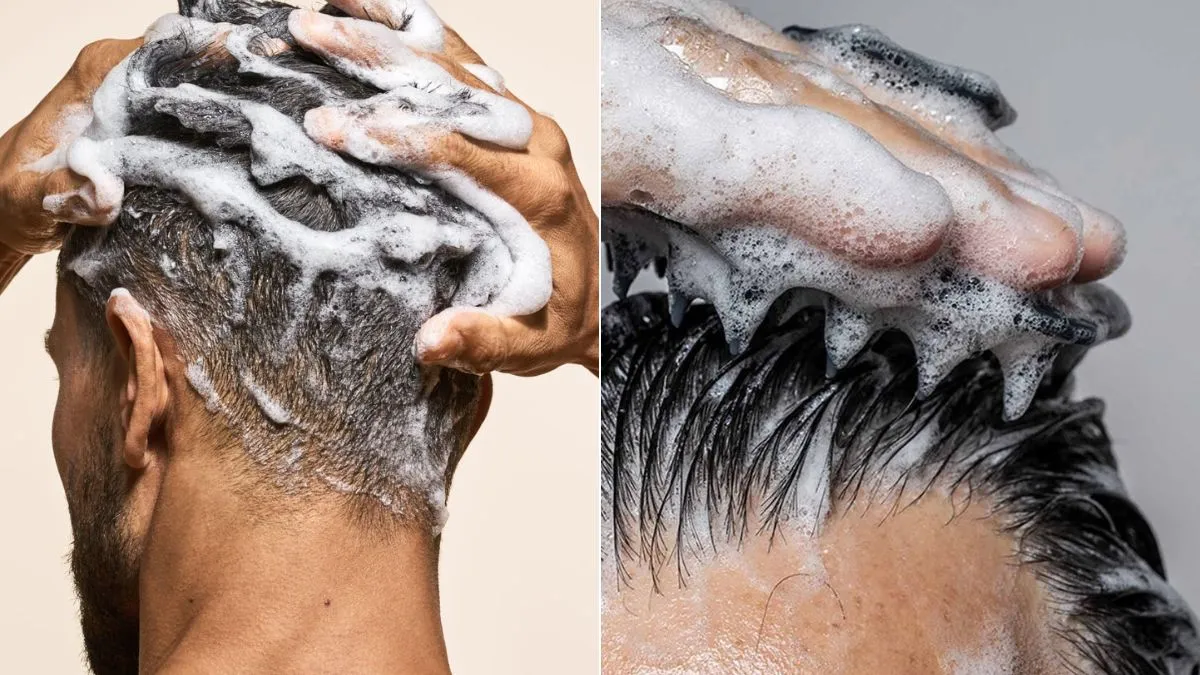 Best Anti-Dandruff Shampoo Options